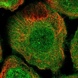 TBC1D9B Antibody, Novus Biologicals 0.1mL; Unlabeled:Antibodies, Polyclonal
